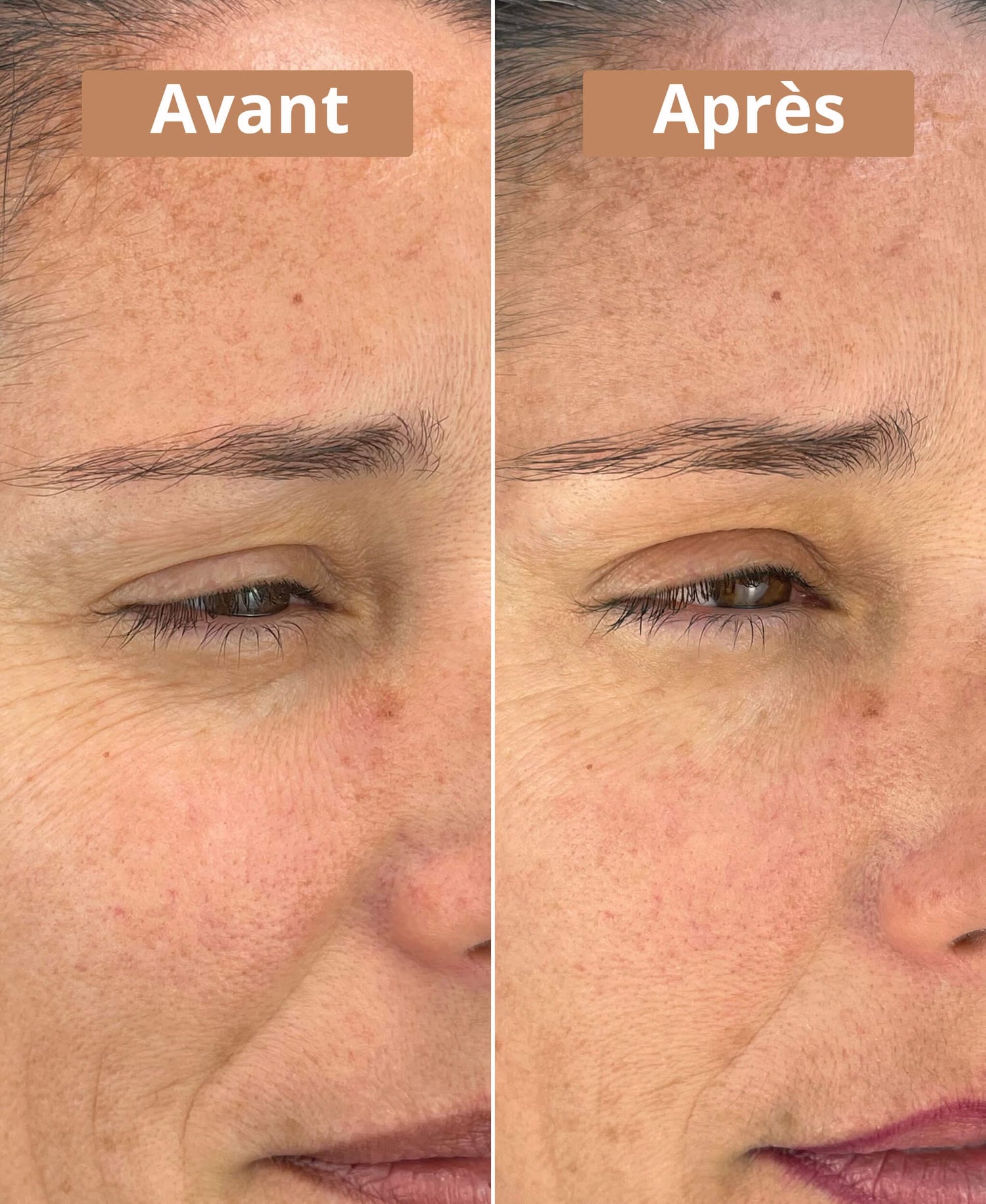 Sérum contour des yeux bio – Hydratant & défatigant